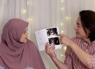 Cut Meyriska Ungkap Jenis Kelamin Anak Kedua, Bolehkah dalam Islam? Cut Meyriska