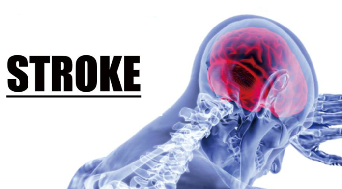 cara allah mengobati stroke