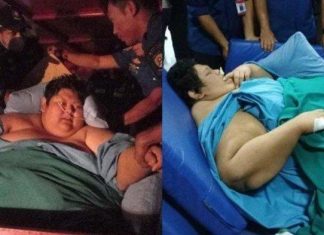Fajri obesitas meninggal