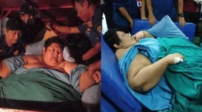 Fajri obesitas meninggal