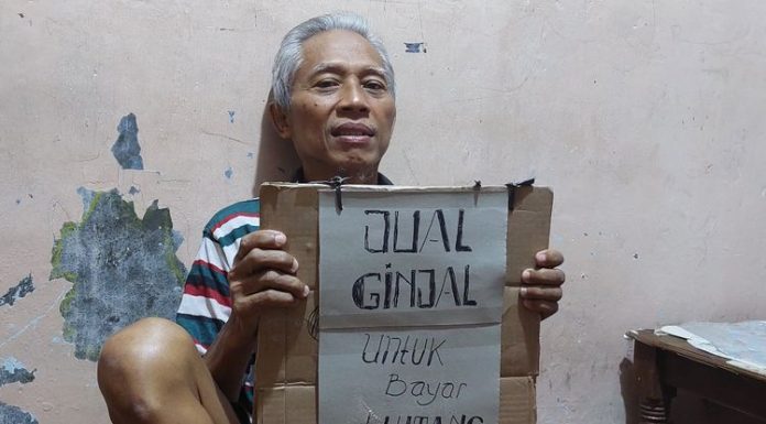 Harganya Fantastis, Begini Hukum Menjual Ginjal Hukum Menjual Ginjal