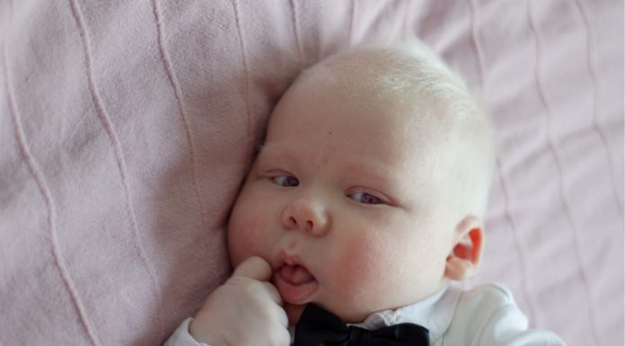 Anak Albino Di Wonogiri, Ini Pendapat Al-Quran Tentang Perbedaan Warna Kulit