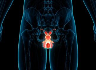 Kanker Testis