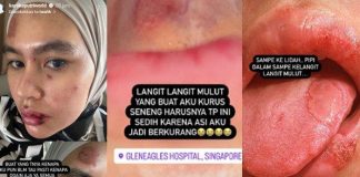 penyakit Kartika Putri