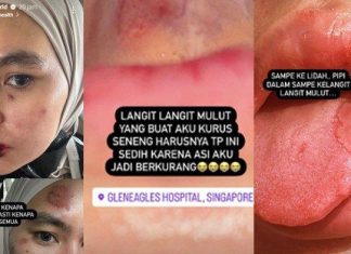 penyakit Kartika Putri