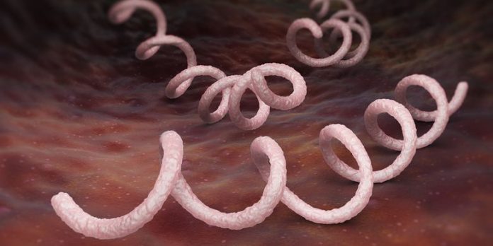 penyakit kelamin sifilis