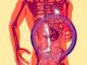 qiyas dalam fatwa transplantasi organ