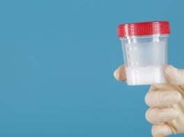 tes sperma puasa berapa hari