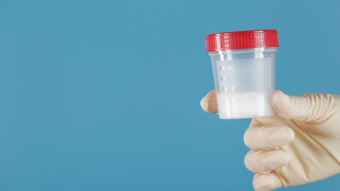 tes sperma puasa berapa hari