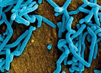 virus marburg